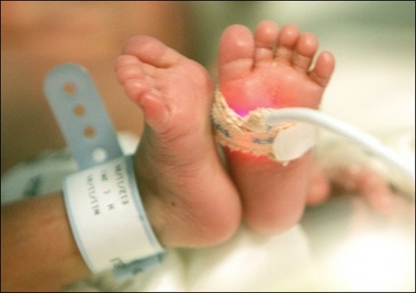 650 bebés muertos por eutanasia en Holanda