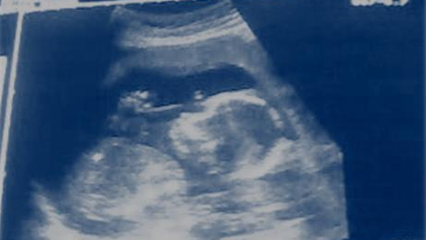 El reconocimiento de los derechos humanos del embrión en la legislación argentina