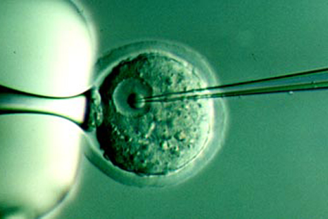 El embrión postergado: regulaciones administrativas sobre Procreación Artificial en Argentina